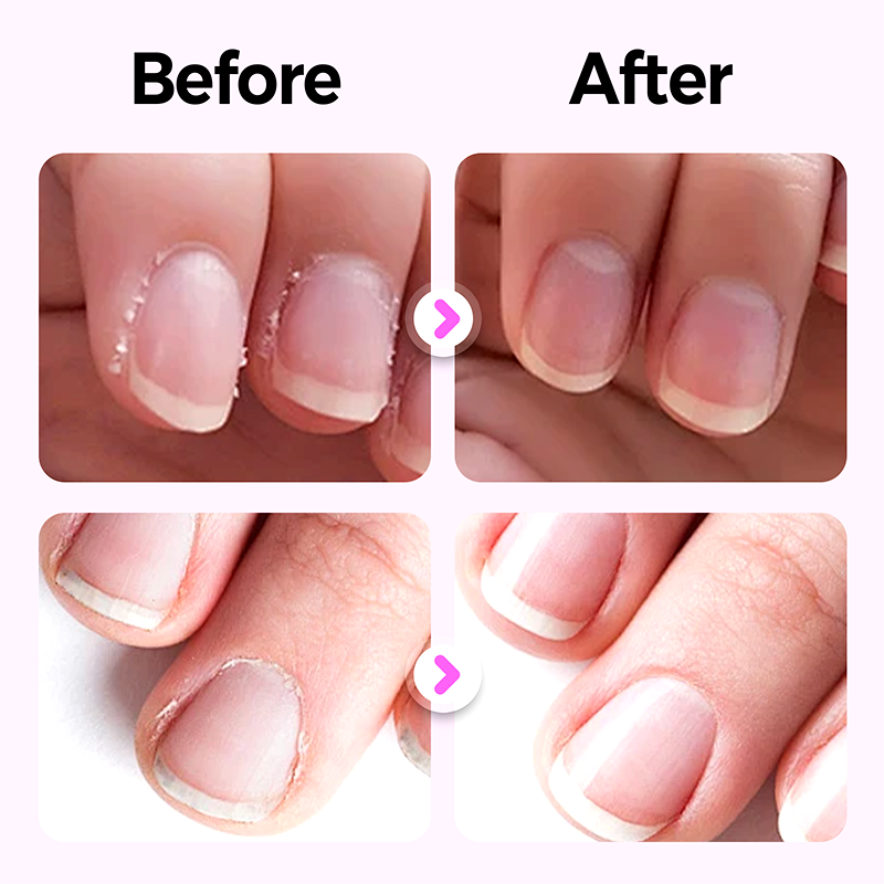 💜 3 в 1 писалка за грижа за ноктите 【Купуваш 1 и получаваш 2 безплатно】💅